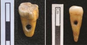 Human teeth