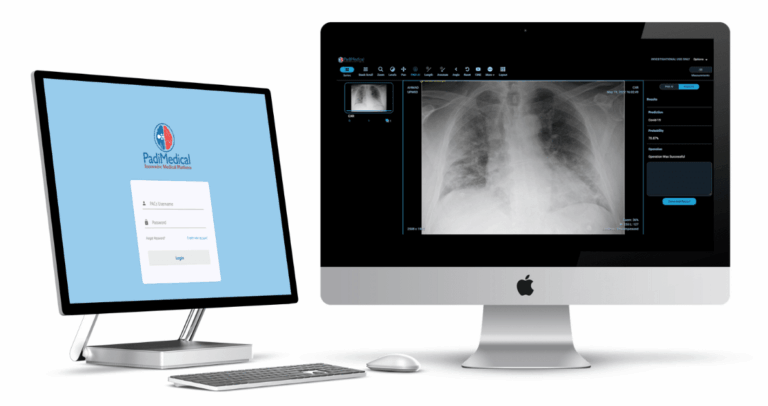PadiMedical-System-replaces-the-manual-film-or-CD-method-and-acts-as-a-Supplementary-CloudPACS-with-the-integration-of-Artificial-Intelligence-to-accelerate-the-patient-critical-data-sharing
